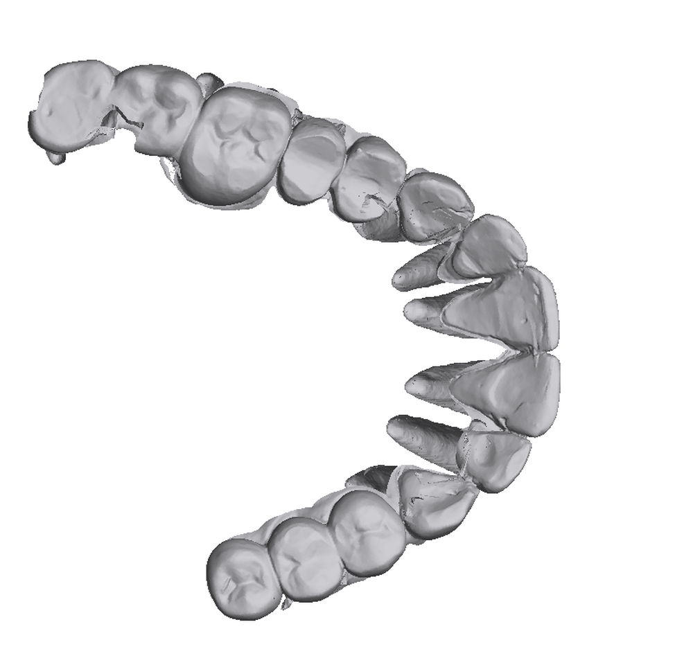 A fused upper arch seen from the occlusal side: fourteen teeth, each a closed solid, with their CBCT roots visible below the scanned crowns.